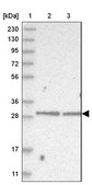 Anti-ZC2HC1A antibody produced in rabbit Prestige Antibodies® Powered by Atlas Antibodies, affinity isolated antibody, buffered aqueous glycerol solution