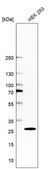 Anti-CSNK2B antibody produced in rabbit Prestige Antibodies® Powered by Atlas Antibodies, affinity isolated antibody, buffered aqueous glycerol solution