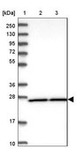 Anti-DHRS9 antibody produced in rabbit Prestige Antibodies® Powered by Atlas Antibodies, affinity isolated antibody, buffered aqueous glycerol solution