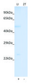 Anti-SLC25A26 (N-terminal) antibody produced in rabbit affinity isolated antibody