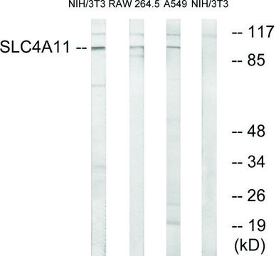 Anti-SLC4A11 antibody produced in rabbit affinity isolated antibody