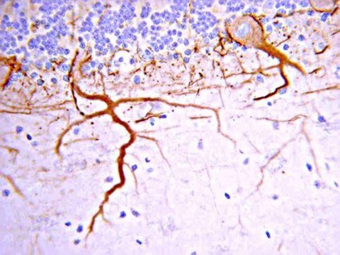 抗神经丝M（145 kDa）抗体，CT serum, Chemicon&#174;