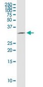 Monoclonal Anti-HSD17B12 antibody produced in mouse clone 4G11, purified immunoglobulin, buffered aqueous solution