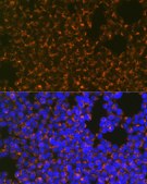 Anti-CCR8 Antibody, clone 9N1Y1, Rabbit Monoclonal