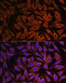 Anti-GIT1 antibody produced in rabbit