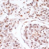 Anti-Phospho-Stat3-Y705 antibody produced in rabbit