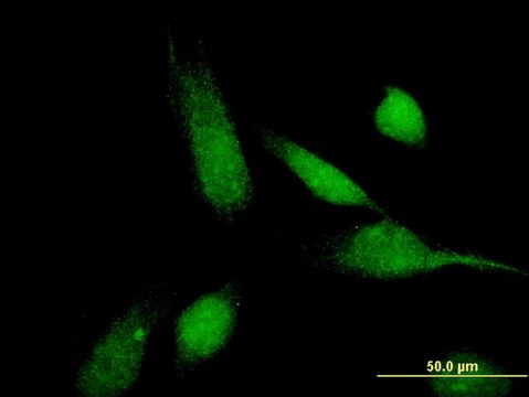 Monoclonal Anti-ABCC11 antibody produced in mouse clone 4H6, purified immunoglobulin, buffered aqueous solution