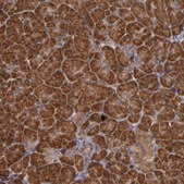 Anti-RIOK3 antibody produced in rabbit Prestige Antibodies® Powered by Atlas Antibodies, affinity isolated antibody, buffered aqueous glycerol solution