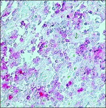 Monoclonal Anti-Rabbit IgG (&#947;-chain specific)&#8722;Alkaline Phosphatase antibody produced in mouse clone RG-96, purified immunoglobulin, buffered aqueous glycerol solution