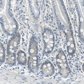 Anti-FKBP4 antibody produced in rabbit Prestige Antibodies® Powered by Atlas Antibodies, affinity isolated antibody, buffered aqueous glycerol solution