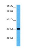 Anti-CDX2 antibody produced in rabbit affinity isolated antibody