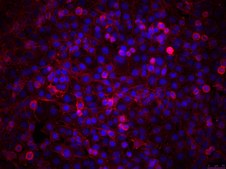 T24T Human Bladder Carcinoma Cell Line