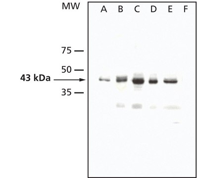 抗AtMPK4 兔抗 affinity isolated antibody, liquid