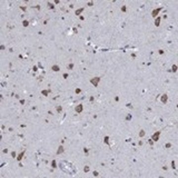 Anti-TMEM59 antibody produced in rabbit Prestige Antibodies&#174; Powered by Atlas Antibodies, affinity isolated antibody, buffered aqueous glycerol solution