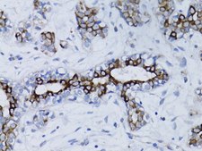 Anti-BRCA1 antibody produced in rabbit