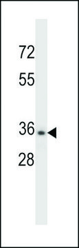 ANTI-CELA3B(N-TERMINAL) antibody produced in rabbit affinity isolated antibody, buffered aqueous solution