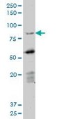 Monoclonal Anti-DAZ1 antibody produced in mouse clone 3E3, purified immunoglobulin, buffered aqueous solution