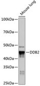 Anti-DDB2 antibody produced in rabbit