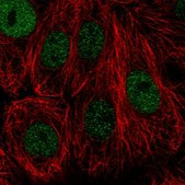 Anti-TONSL antibody produced in rabbit Prestige Antibodies® Powered by Atlas Antibodies, affinity isolated antibody, buffered aqueous glycerol solution