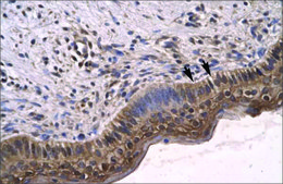 Anti-SIRT5 antibody produced in rabbit affinity isolated antibody