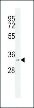 ANTI-HSD17B11(N-TERMINAL) antibody produced in rabbit affinity isolated antibody, buffered aqueous solution