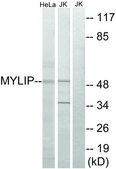 Anti-MYLIP antibody produced in rabbit affinity isolated antibody