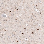 Anti-CALB2 antibody produced in mouse Prestige Antibodies® Powered by Atlas Antibodies, clone CL12838, purified by using Protein A, buffered aqueous glycerol solution