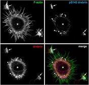 Anti-phospho Drebrin (Ser142), clone 3C14 Antibody clone 3C14, from mouse