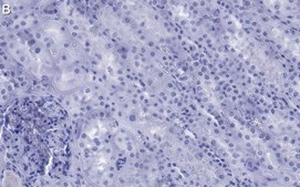 Anti-NOTCH2 Antibody, clone 1B14-5 ZooMAb® Rabbit Monoclonal recombinant, expressed in HEK 293 cells