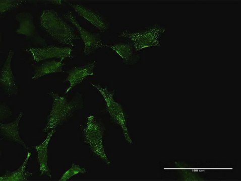 Anti-TEX264 antibody produced in rabbit purified immunoglobulin, buffered aqueous solution