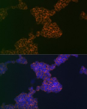 Anti-CD3G antibody produced in rabbit