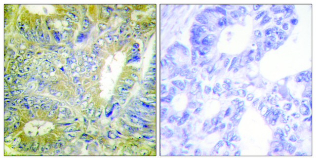 Anti-Desmin antibody produced in rabbit affinity isolated antibody