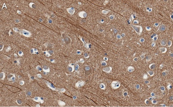 Anti-Presenilin-1 Antibody, clone 2O13 ZooMAb&#174; Rabbit Monoclonal recombinant, expressed in HEK 293 cells