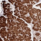 Anti-CPA1 antibody produced in rabbit Prestige Antibodies® Powered by Atlas Antibodies, affinity isolated antibody, buffered aqueous glycerol solution