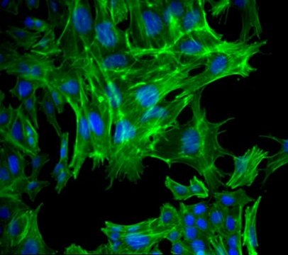 AT-3 Mouse Mammary Carcinoma Cell Line AT-3 mouse mammary tumor cell line may be used to develop mouse models for mammary cancer studies.