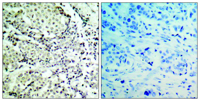 Anti-MKK6 antibody produced in rabbit affinity isolated antibody