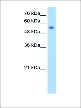 Anti-UGT3A2 antibody produced in rabbit IgG fraction of antiserum