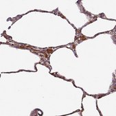 Anti-CASP2 antibody produced in rabbit Prestige Antibodies® Powered by Atlas Antibodies, affinity isolated antibody, buffered aqueous glycerol solution