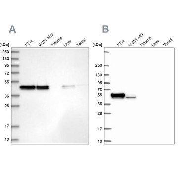 Anti-RCN1 antibody produced in rabbit Prestige Antibodies&#174; Powered by Atlas Antibodies, affinity isolated antibody, buffered aqueous glycerol solution