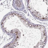 Anti-MEIOC antibody produced in rabbit Prestige Antibodies® Powered by Atlas Antibodies, affinity isolated antibody, buffered aqueous glycerol solution, Ab2