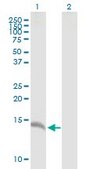 Anti-CALML3 antibody produced in mouse IgG fraction of antiserum, buffered aqueous solution