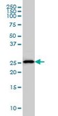 Monoclonal Anti-HLA-DMA antibody produced in mouse clone 3F12-F11, purified immunoglobulin, buffered aqueous solution