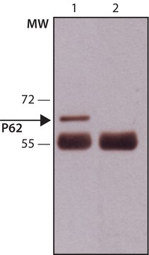 抗-p62/SQSTM1 （C-末端） 兔抗 affinity isolated antibody, buffered aqueous solution