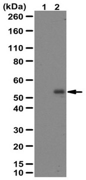 抗磷酸SMAD2抗体（Ser465/467） from rabbit, purified by affinity chromatography