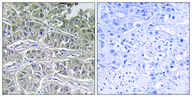 Anti-SLC25A21 antibody produced in rabbit affinity isolated antibody