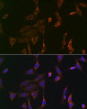 Anti-KRAS+HRAS+NRAS antibody produced in rabbit