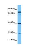 Anti-IGFBP4 antibody produced in rabbit affinity isolated antibody