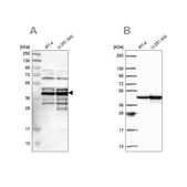 Anti-SLBP antibody produced in rabbit Prestige Antibodies® Powered by Atlas Antibodies, affinity isolated antibody, buffered aqueous glycerol solution