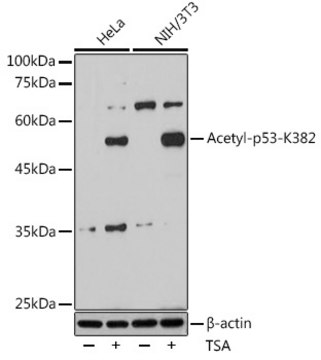 Anti-Acetyl-p53-K382 Antibody, clone 0, Rabbit Monoclonal