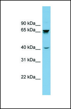 Anti-ACHE antibody produced in rabbit affinity isolated antibody